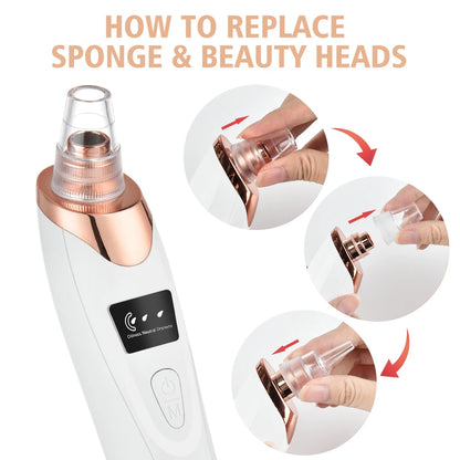 Blackhead and Acne Cleaner Vacuum