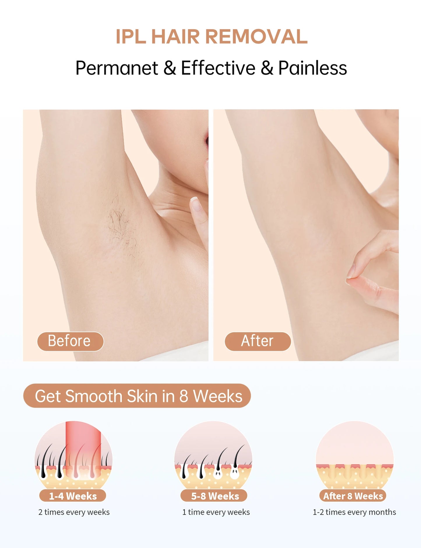 IPL Hair Removal Laser