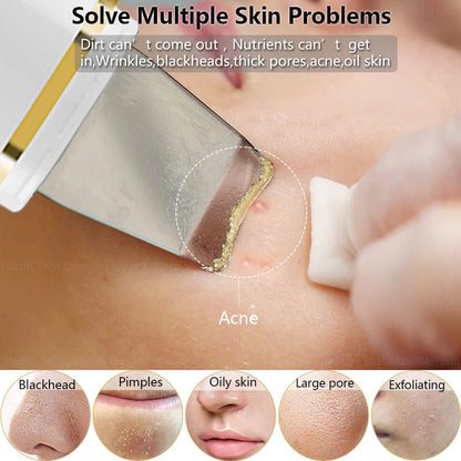 Z9 Ultrasonic Acne & Blackhead Remover